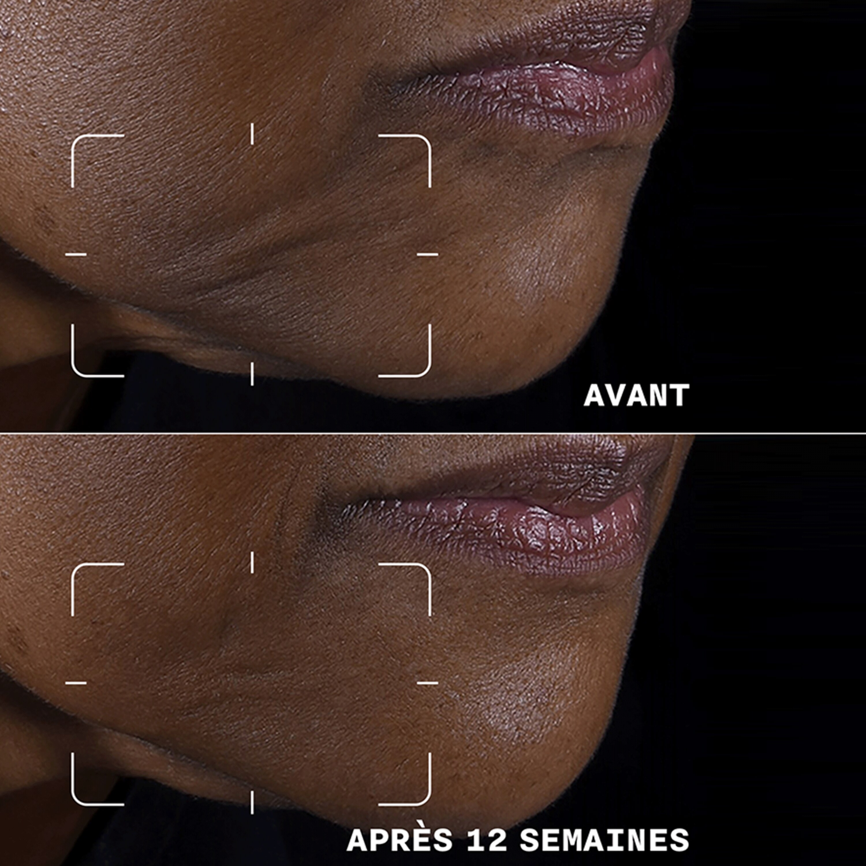 CLINIQUE SMART CLINICAL REPAIR